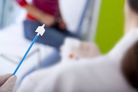 자궁 경부암 검진의 발전 : 자기 수집 HPV 테스트의 역할
