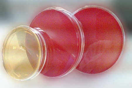 Salmonella Shigella Agar (SS) : 병원체 분리를위한 필수 매체