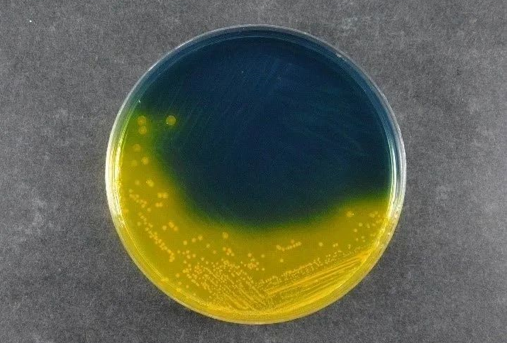 식품 안전 보장 : Babio 's Salmonella Shigella Agar (SS)는 글로벌 병원체 탐지 표준을 지원합니다.