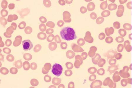 Babio는 글로벌 실험실을위한 고품질 Giemsa Stain 솔루션을 출시합니다