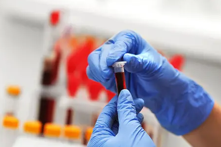 Babio는 신뢰할 수있는 임상 표본 운송을위한 액체 아미 미디어를 소개합니다.